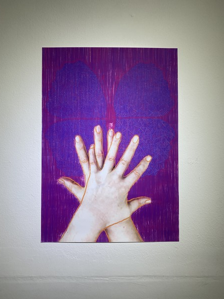 허왕정 작가가 참여한 환자들의 손 사진에 평소 좋아하는 색과 이미지를 반영해서 작업한 제품
